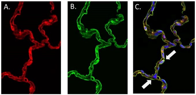 Comparison of Rabbit and Mouse anti-β Actin mAb's in monkey lung