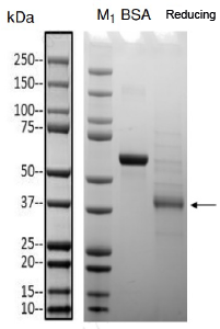 Transmembrane Proteins- LPAR1